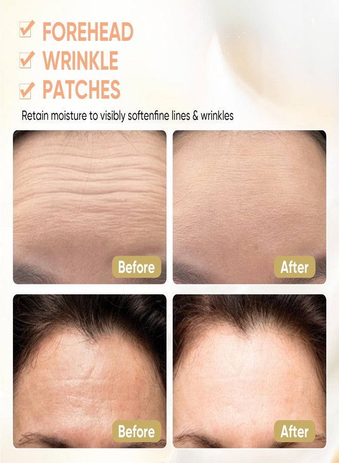 InfiniteRelax 12Pcs Forehead Wrinkle Patches for Women, Hydrolyzed | Collagen | Vitamin E | Aloe Vera to Reduce Wrinkles Forehead Wrinkles Treatment Overnight (Milky white) - Image 4
